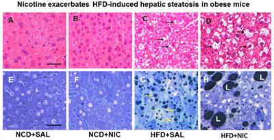 Connection of Nicotine to Diet-Induced Obesity and Non-Alcoholic Fatty Liver Disease: Cellular and Mechanistic Insights